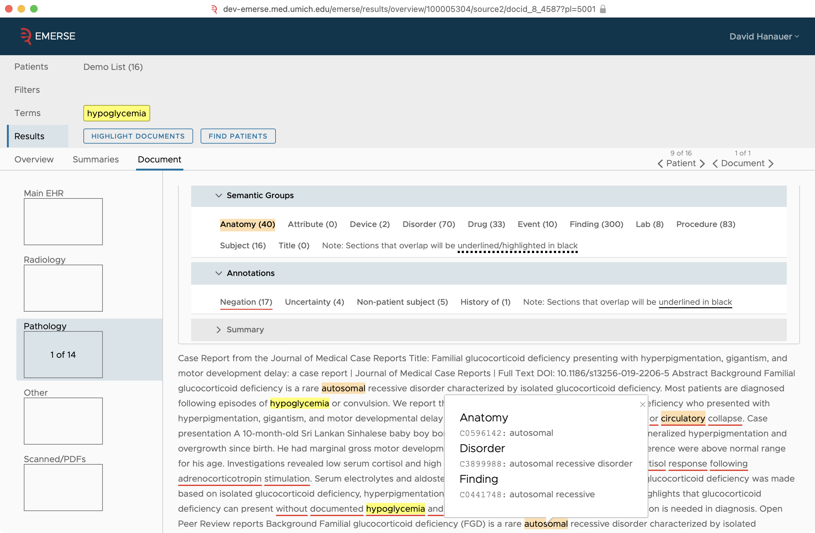 NLP example