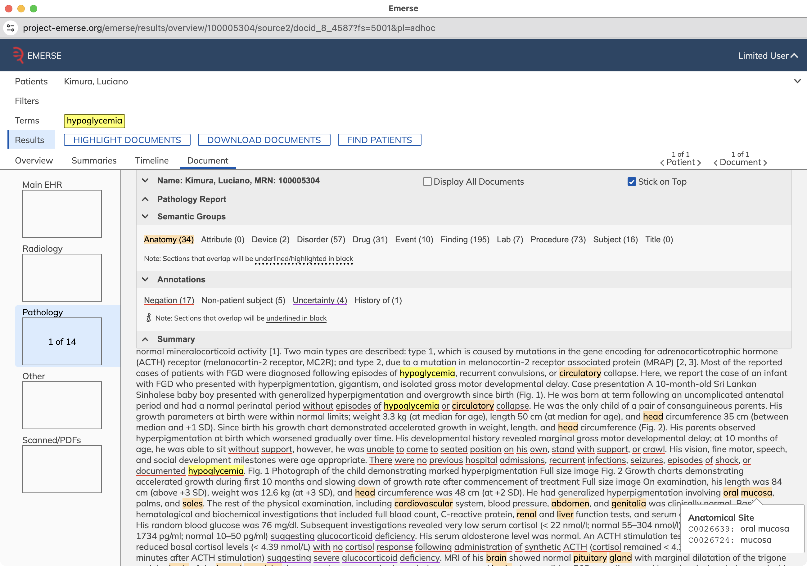 NLP example